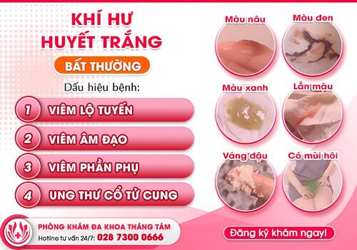 Bệnh huyết trắng 