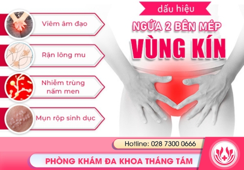 Cần cảnh giác trước dấu hiệu ngứa 2 bên mép vùng kín